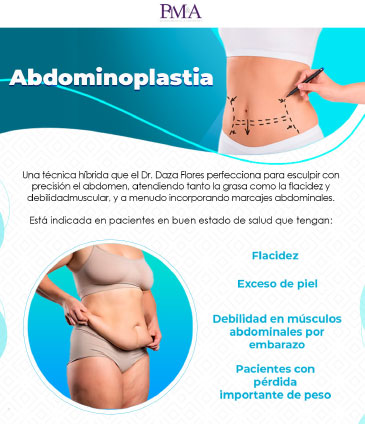 Abdominoplastia