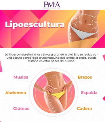 Lipoabdominoplastia