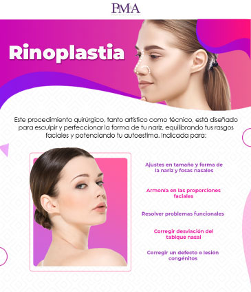 Rinoplastia